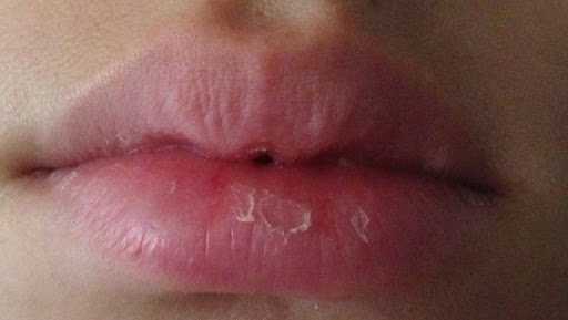 Des chercheurs ont découvert une nouvelle façon de traiter les lèvres sèches
