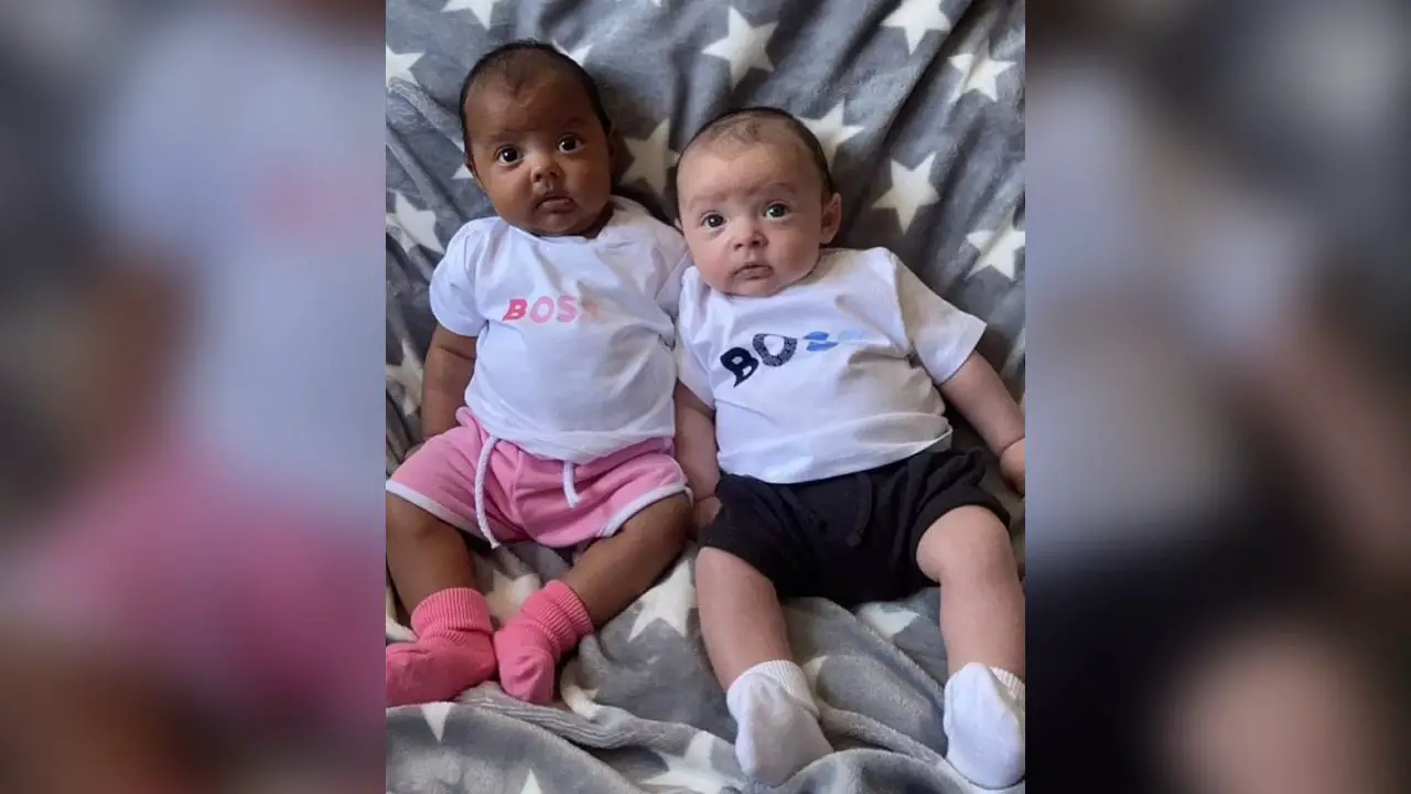 Angleterre: une mère de 29 ans a accouché des jumeaux de couleur de peau différente
